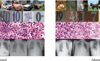 Training Neural Network to Detect Anomalies in Medical Images Using AI